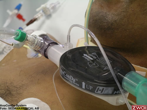 AnaConda im Einsatz - Foto: SEDANAMEDICAL AB