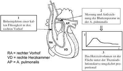 Abb. 2: Schematische Zeichnung des Messprinzip des PAK