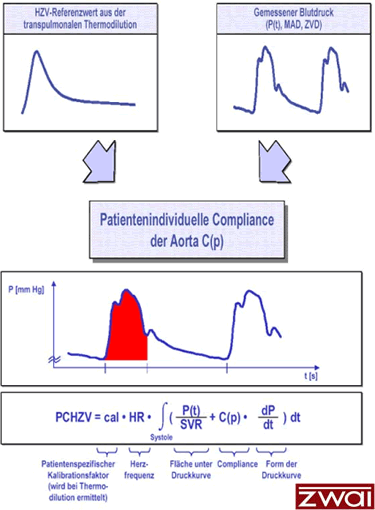 Abb. 4: Pulskonturanalyse