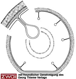 Abb. 1 Schematische Darstellung der Cuffkan�lchen /-stra�en /-falten.
Quelle: microcuff GmbH, Weinheim.
